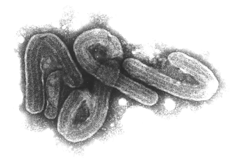 Elektronenmikroskopische Aufnahme des Marburg-Virus